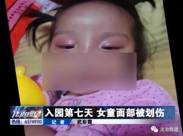 平頂山3歲女童上幼兒園 入園7天突然發生意外